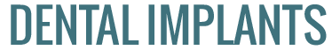 Dental Implants